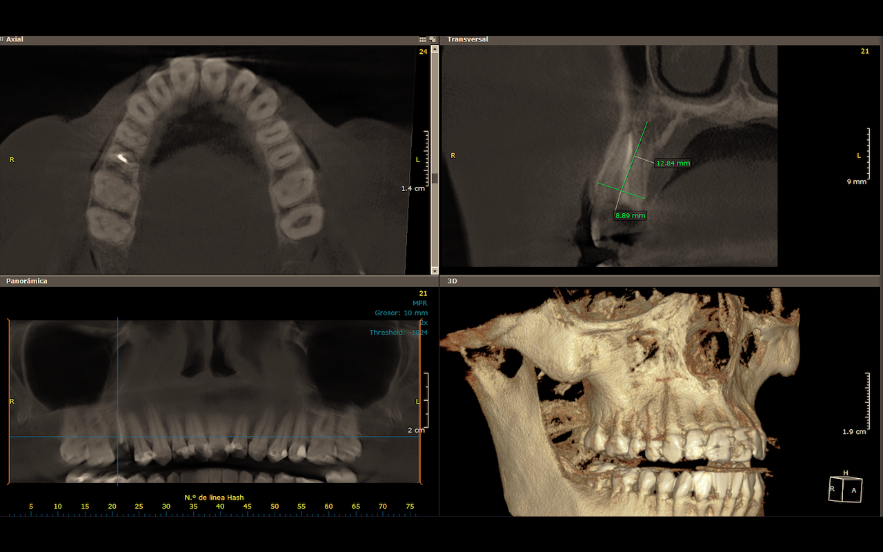 scanner_3d scanner_3d