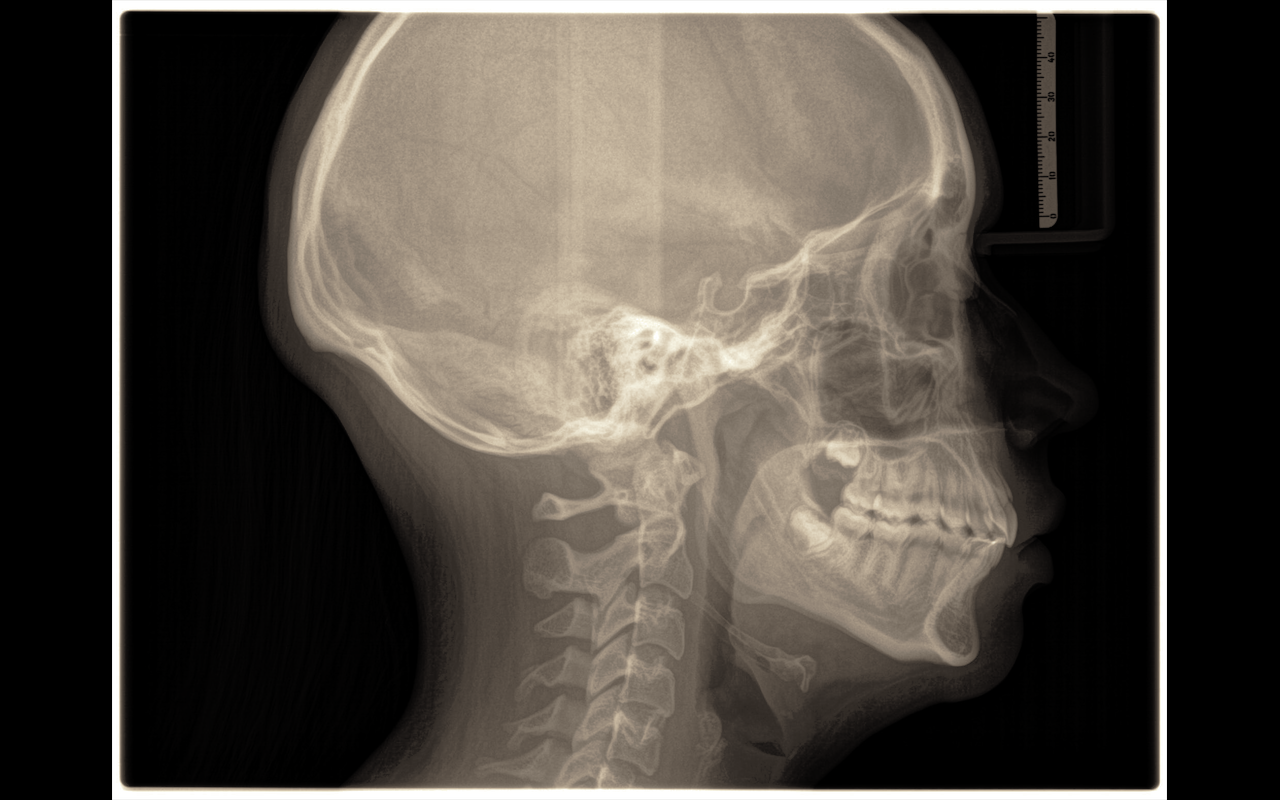 telerradiografia telerradiografia